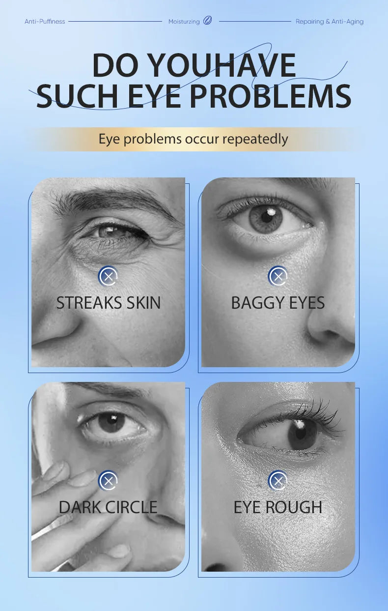 Remove Wrinkles Eye Cream Anti Dark Circles Bags Puffiness Fade Eye Fine Line Tighten Whiten Under Eyes Skin Care