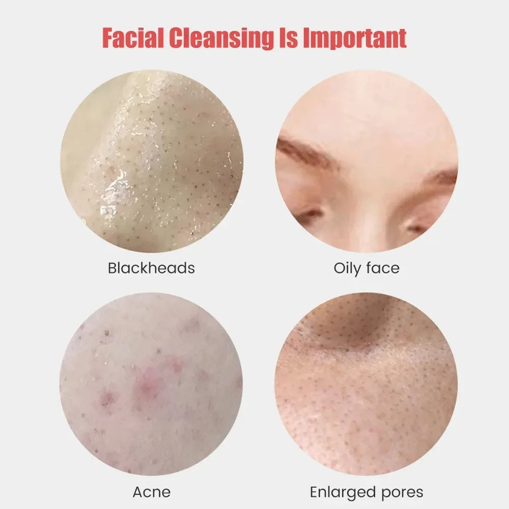 Sonic Waterproof Facial Cleansing Brush for Men & Women Rechargeable Exfoliating Electric Face Scrubber Cleanser Brush