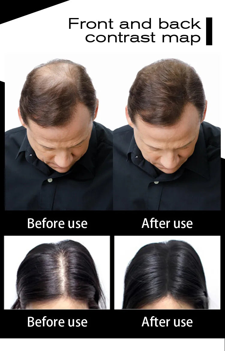 10colors Cosmetic Styling Keratin Powders Building Hair Fibers Black/Dk Brown Hair Styling Powder Instant Thicker Hair 500g