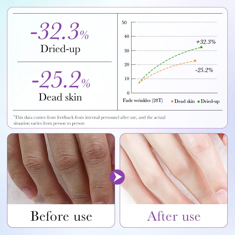 5pack Moisturizing Hand Mask Spa Gloves Exfoliating Hand Patches Gloves Whitening Peeling Remove Dead Skin Lavender Hand Mask