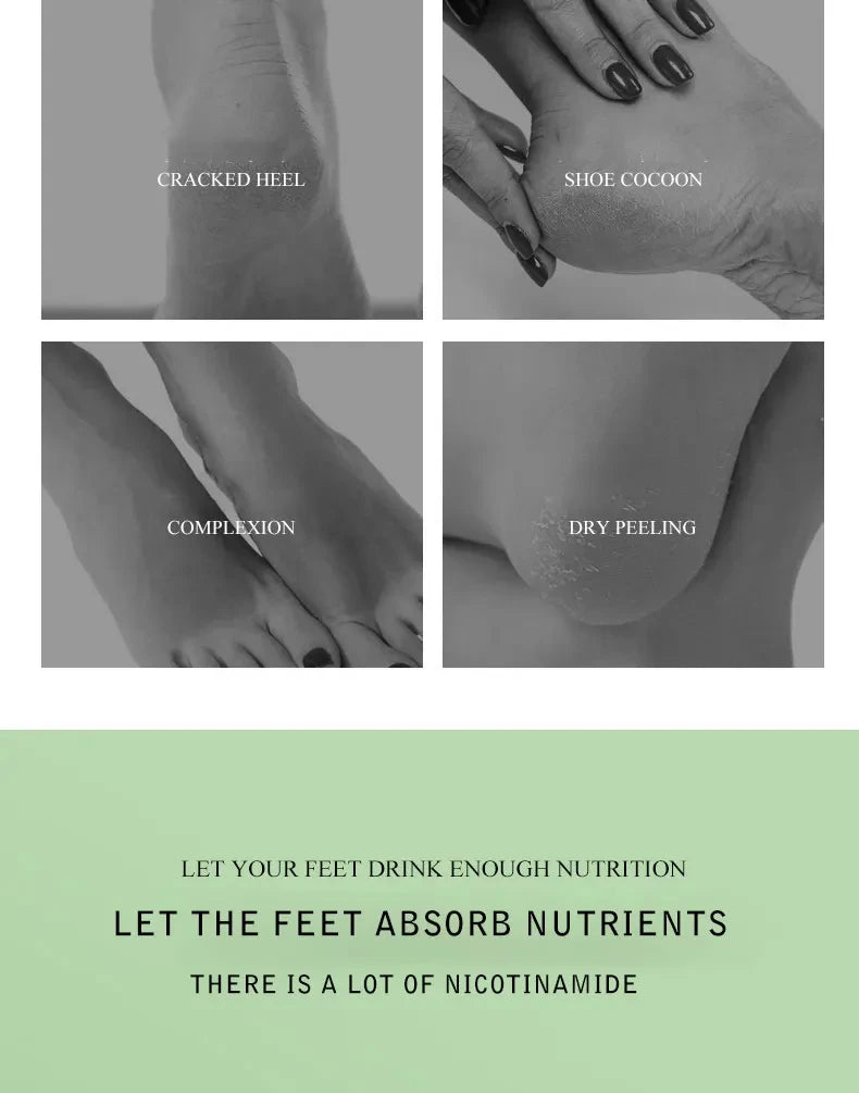 Avocado natural foot mask, exfoliation, spa moisturizing socks, dry elimination, dead skin care