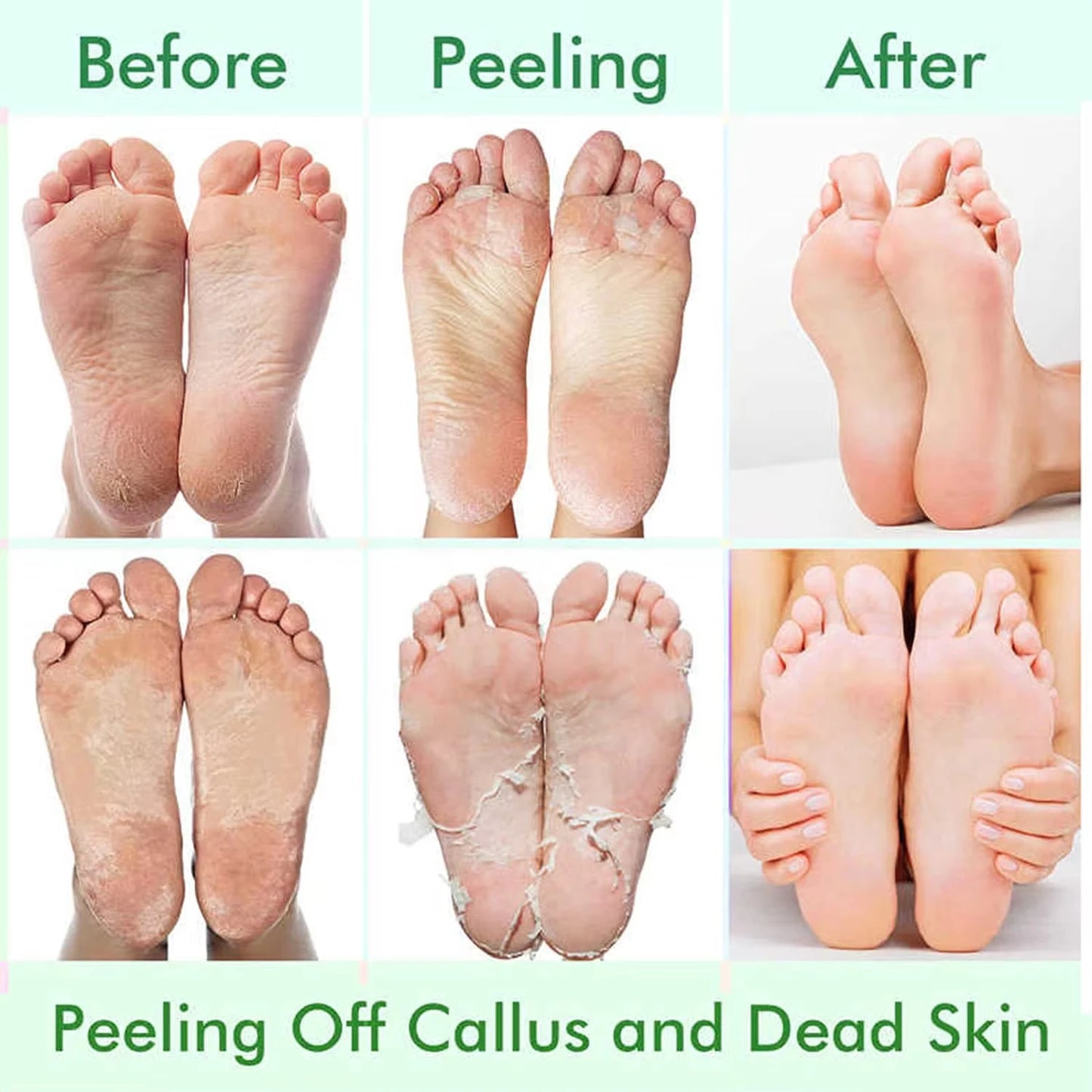 Avocado natural foot mask, exfoliation, spa moisturizing socks, dry elimination, dead skin care