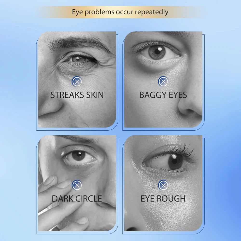 Remove Wrinkles Eye Cream Anti Dark Circles Bags Puffiness Fade Eye Fine Line Tighten Whiten Under Eyes Skin Care